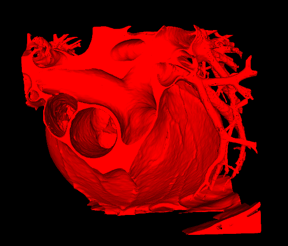 3D model of a heart