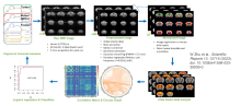 Resting state functional magnetic resonance imaging data analysis pipeline