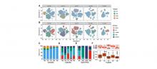 Graphs showing composition of high-grade serous ovarian tumors at single-cell level